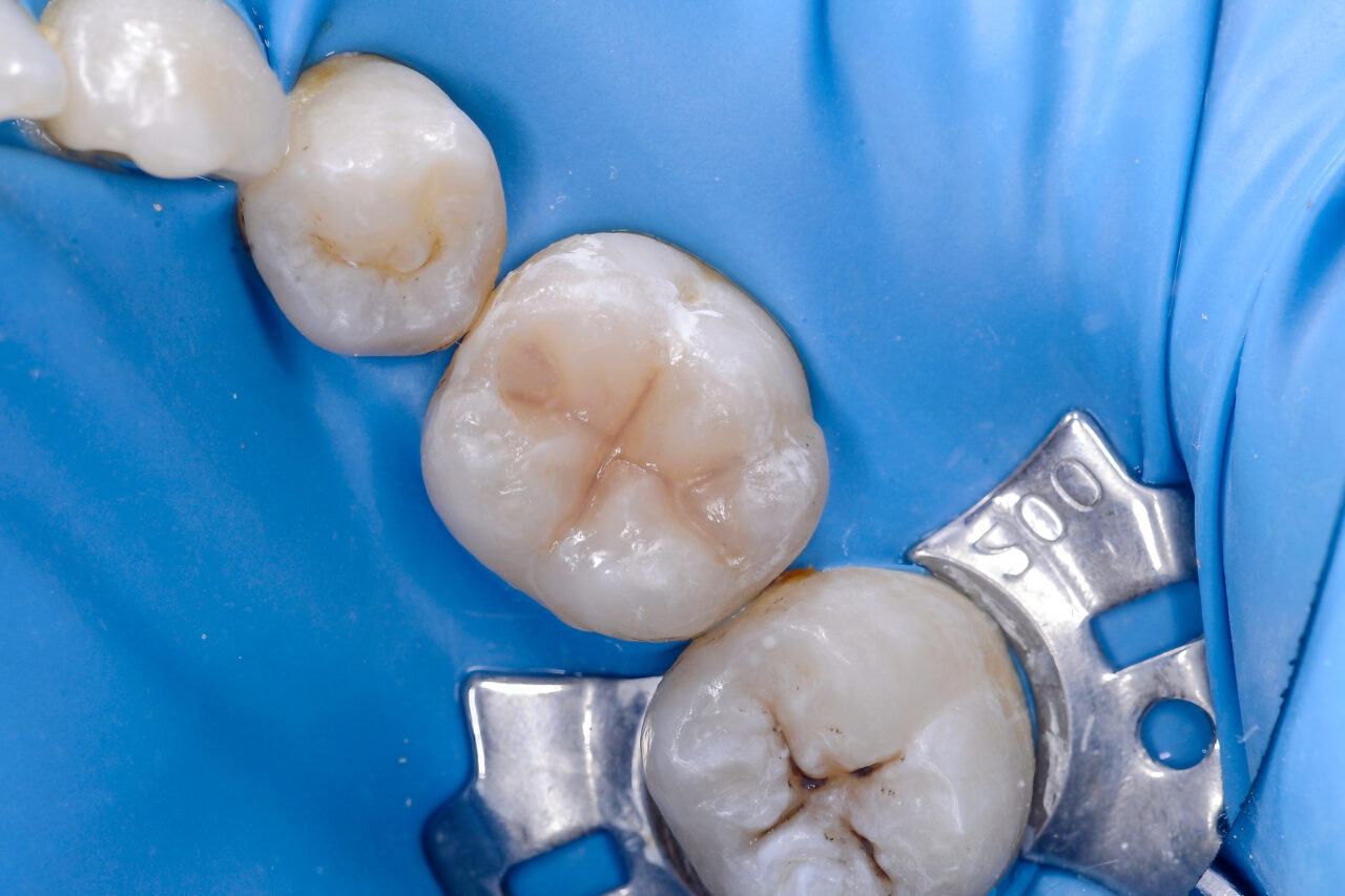 retouch_2024122608351112