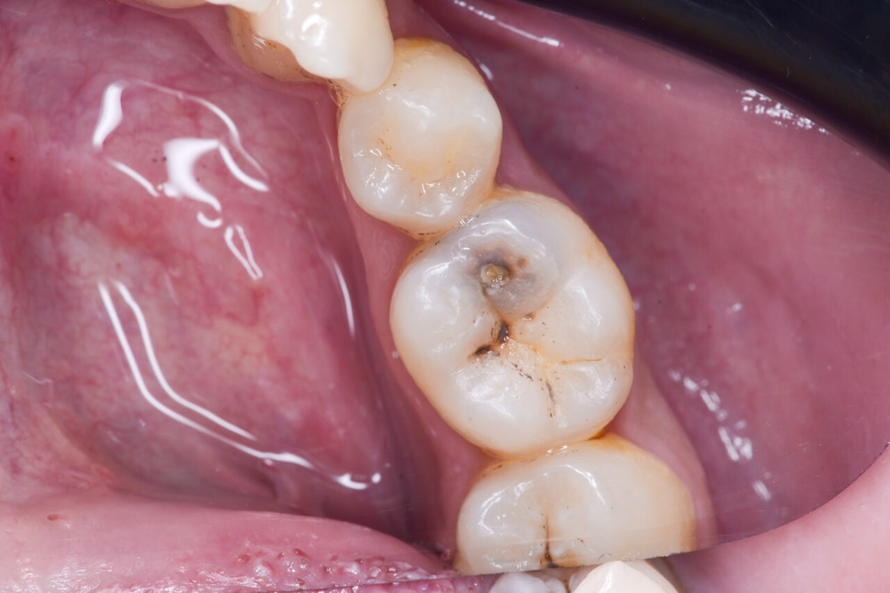 retouch_2024122720461833