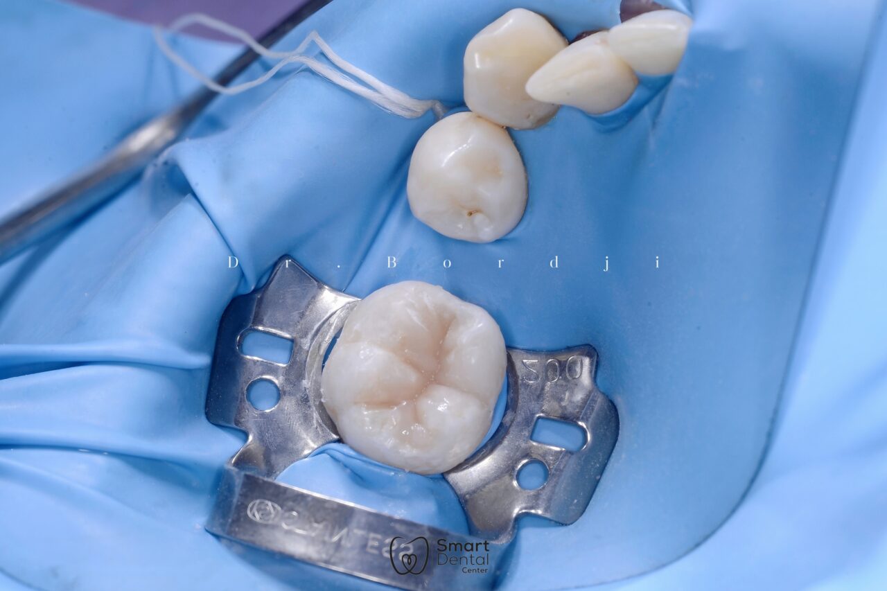 retouch_2025011020211844