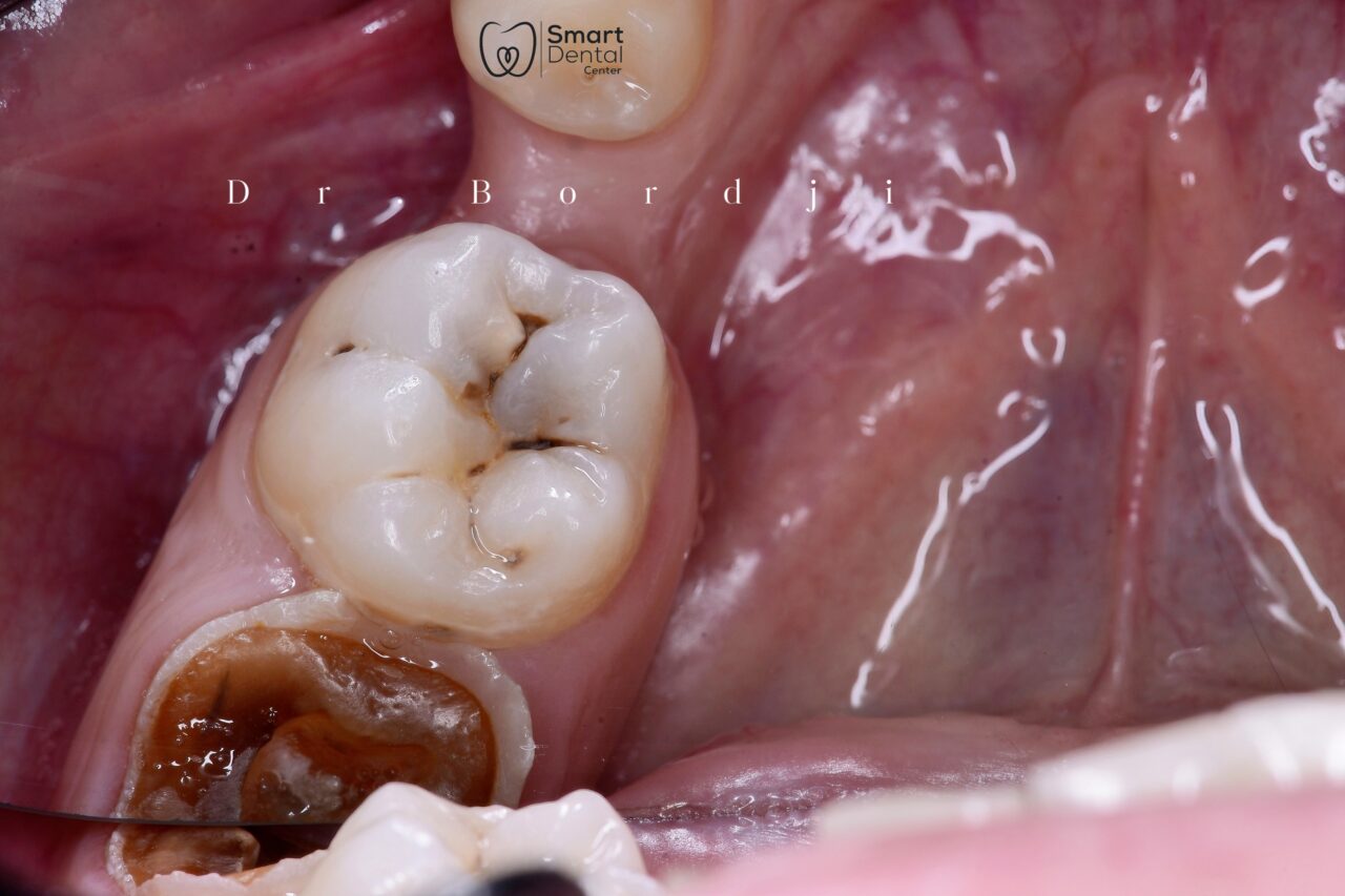 retouch_2025011118300820